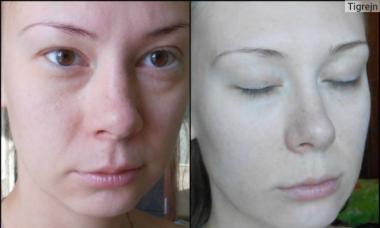 Kozmetička masaža lica kao glavni lijek za poboljšanje stanja kože: opis, vrste masaže lica u kozmetologiji i što daje masaža lica