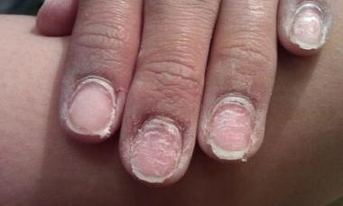 Comment restaurer les ongles après le vernis gel - avis